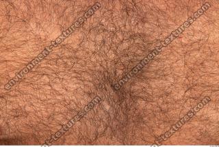 human skin hairy 0007